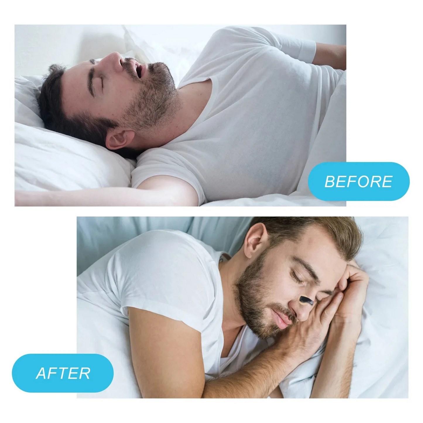 Nasal Breathing Dilators Starter Kit – Magnetic Nose Strips for Better Sleep & Sports Performance