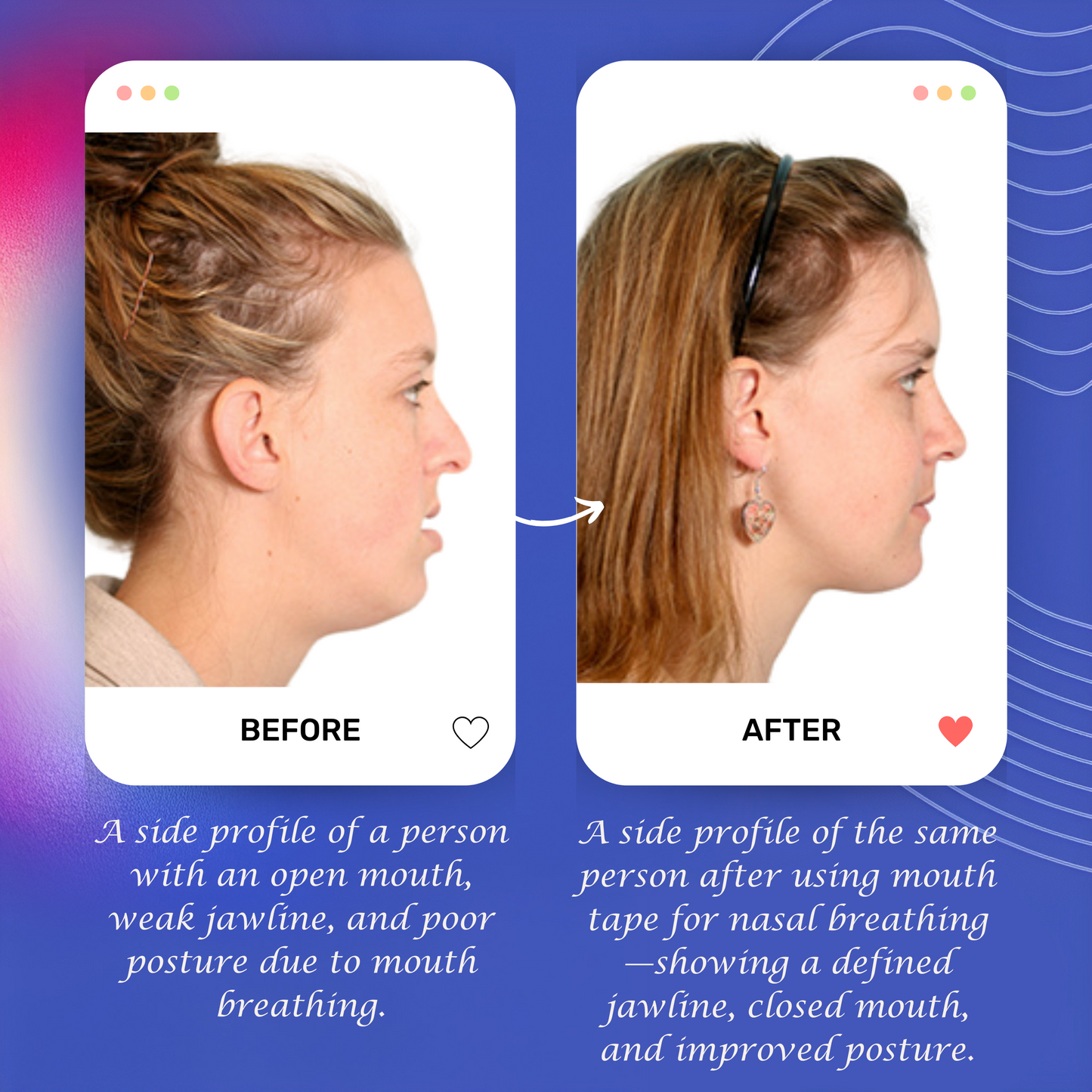 Mouth Tape for Better Sleep – Anti-Snoring & Nose Breathing Strips